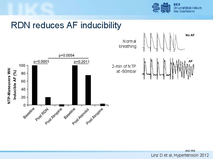 RDN reduces AF inducibility Normal breathing 2 -min of NTP at -80 mbar after