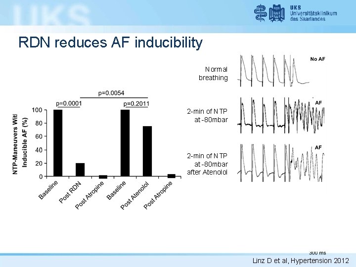 RDN reduces AF inducibility Normal breathing 2 -min of NTP at -80 mbar after