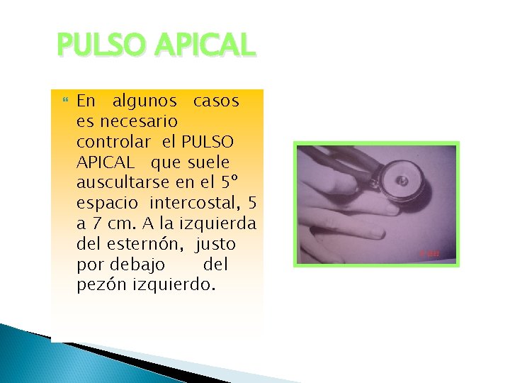 PULSO APICAL En algunos casos es necesario controlar el PULSO APICAL que suele auscultarse