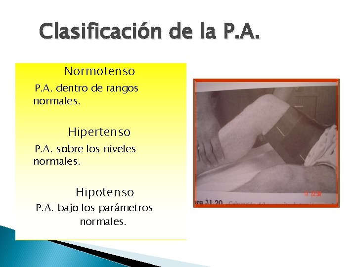 Clasificación de la P. A. Normotenso P. A. dentro de rangos normales. Hipertenso P.