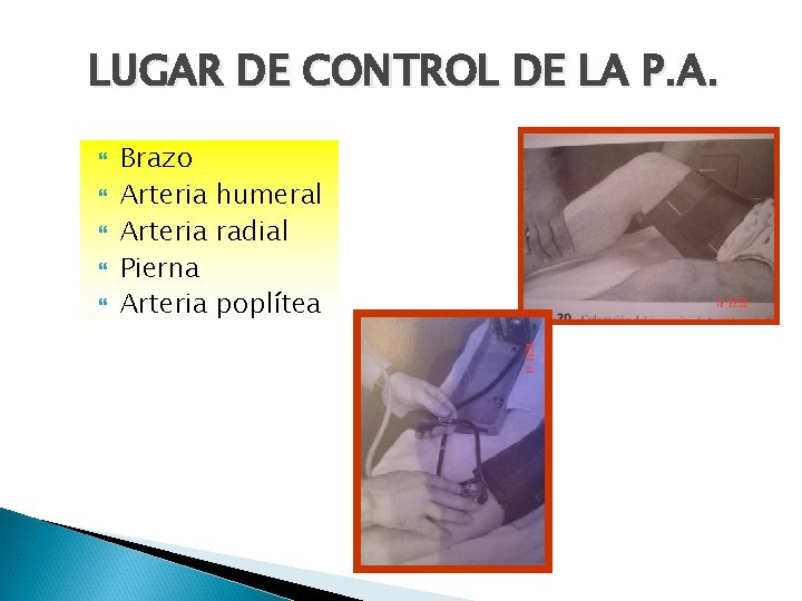 LUGAR DE CONTROL DE LA P. A. Brazo Arteria humeral Arteria radial Pierna Arteria
