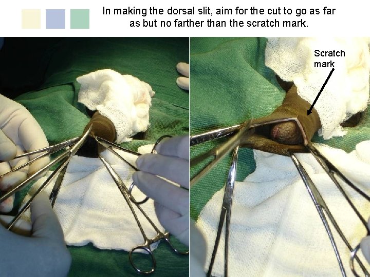 In making the dorsal slit, aim for the cut to go as far as In making the dorsal slit, aim for the cut to go as far as