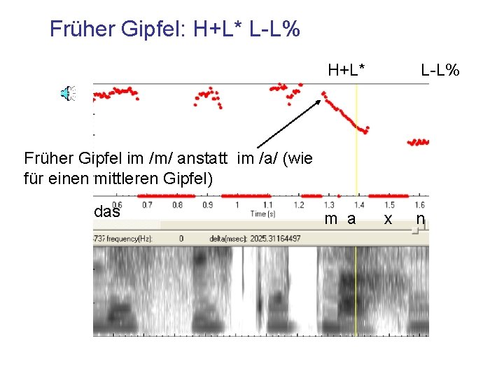 Früher Gipfel: H+L* L-L% Früher Gipfel im /m/ anstatt im /a/ (wie für einen