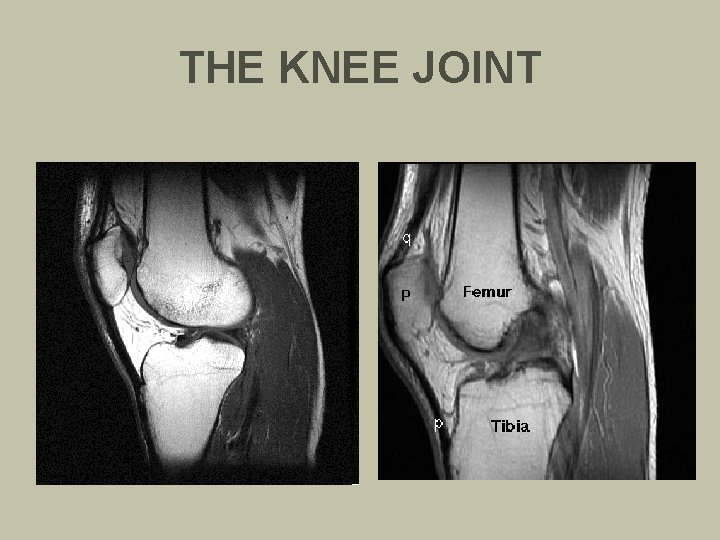 THE KNEE JOINT 