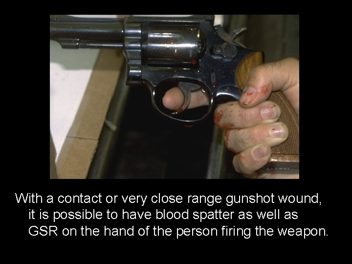 With a contact or very close range gunshot wound, it is possible to have