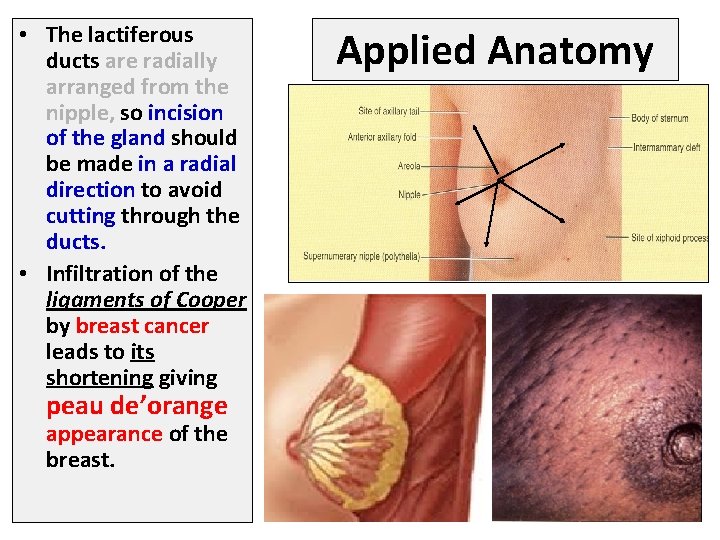  • The lactiferous ducts are radially arranged from the nipple, so incision of