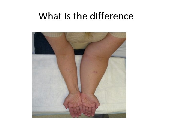 What is the difference 
