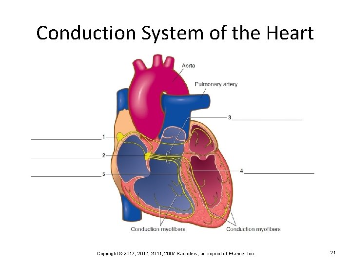 Conduction System of the Heart Copyright © 2017, 2014, 2011, 2007 Saunders, an imprint