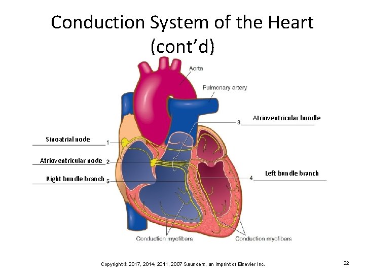 Conduction System of the Heart (cont’d) Atrioventricular bundle Sinoatrial node Atrioventricular node Right bundle