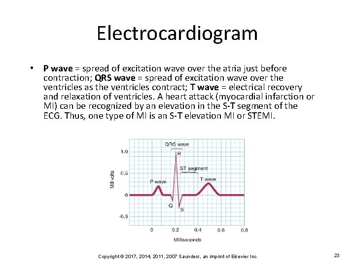 Electrocardiogram • P wave = spread of excitation wave over the atria just before