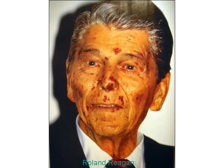 Ein prominentes Opfer: Roland Reagan: 