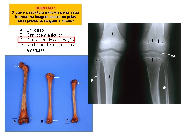 QUESTÃO 1 O que é a estrutura indicada pelas setas brancas na imagem abaixo