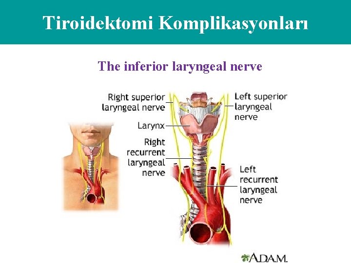 Tiroidektomi Komplikasyonları The inferior laryngeal nerve 