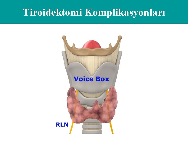 Tiroidektomi Komplikasyonları 