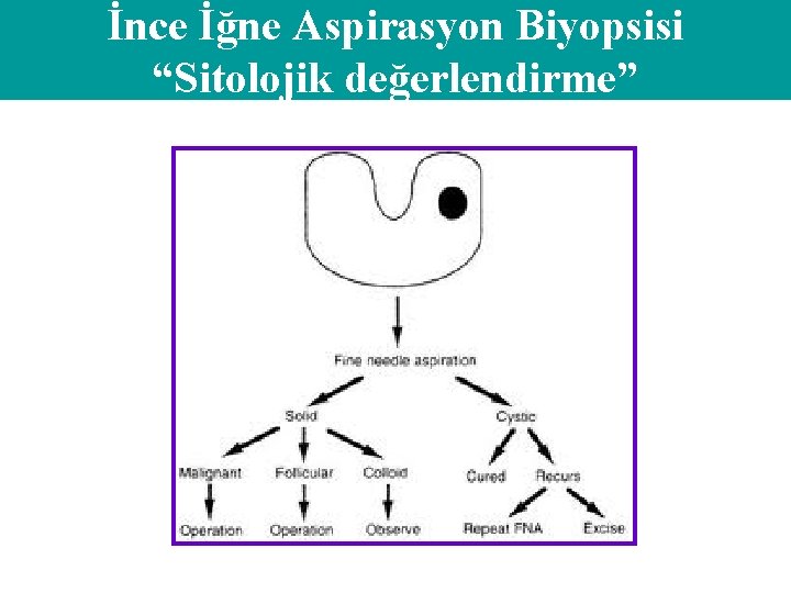 İnce İğne Aspirasyon Biyopsisi “Sitolojik değerlendirme” 