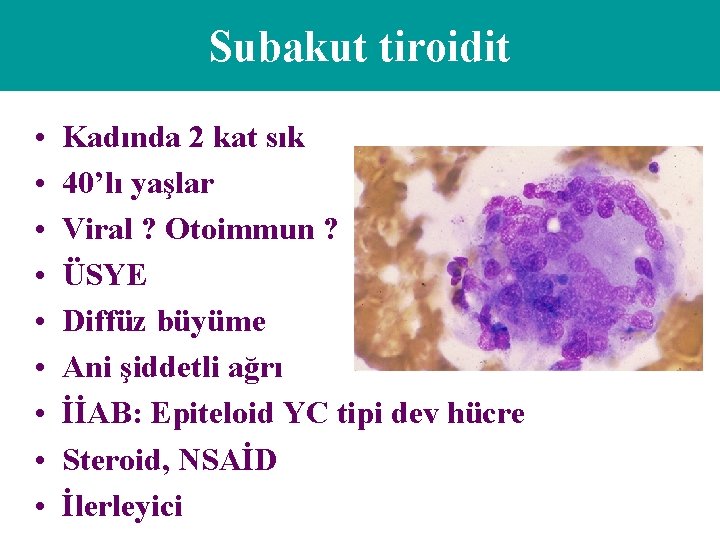 Subakut tiroidit • • • Kadında 2 kat sık 40’lı yaşlar Viral ? Otoimmun