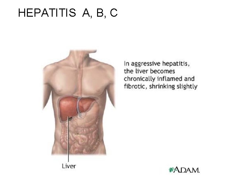 HEPATITIS A, B, C 