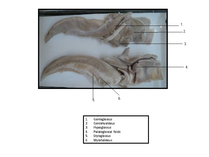 1. 2. 3. 4. 5. 1. 2. 3. 4. 5. 6. Genioglossus Geniohyoideus Hypoglossus