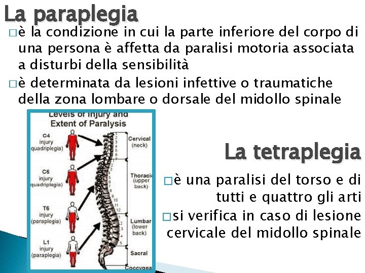 La paraplegia �è la condizione in cui la parte inferiore del corpo di una