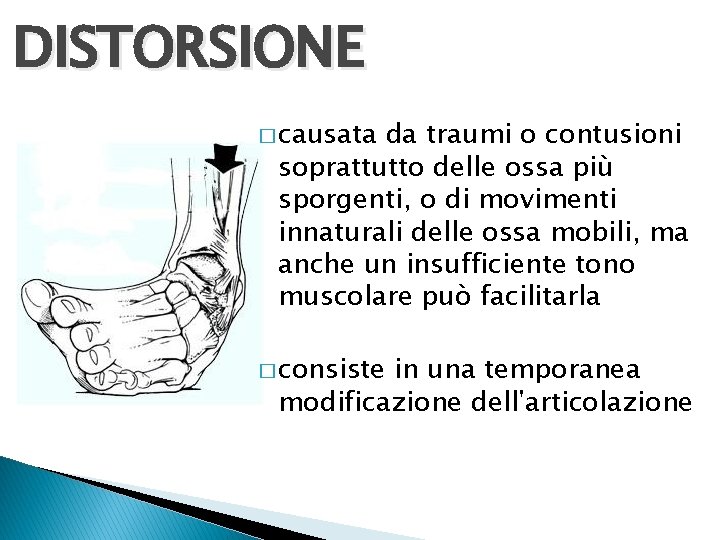 DISTORSIONE � causata da traumi o contusioni soprattutto delle ossa più sporgenti, o di