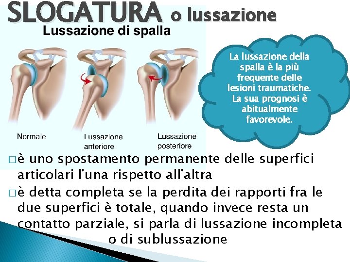 SLOGATURA o lussazione La lussazione della spalla è la più frequente delle lesioni traumatiche.