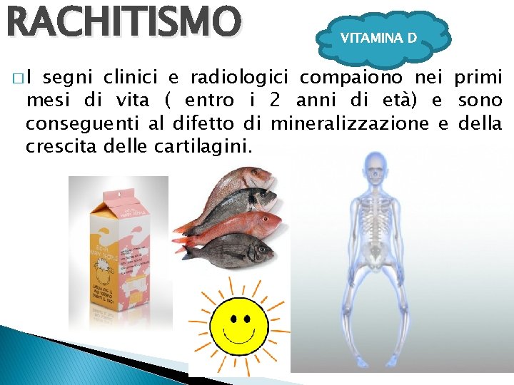 RACHITISMO �I VITAMINA D segni clinici e radiologici compaiono nei primi mesi di vita