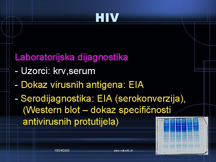 HIV Laboratorijska dijagnostika - Uzorci: krv, serum - Dokaz virusnih antigena: EIA - Serodijagnostika: