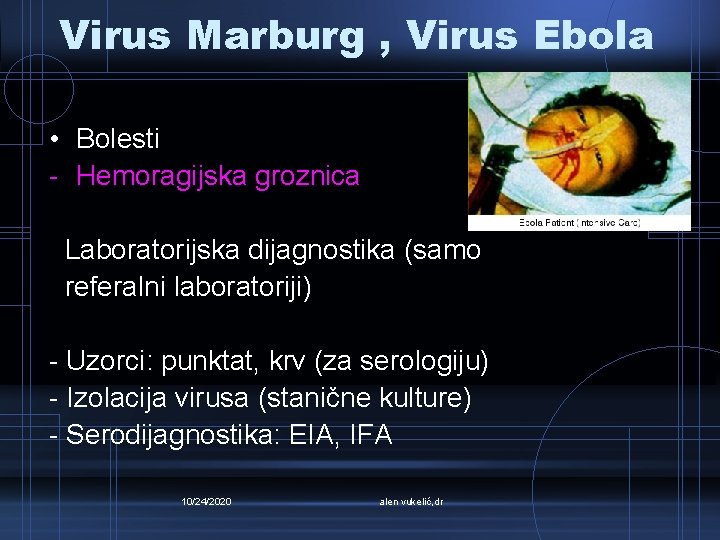 Virus Marburg , Virus Ebola • Bolesti - Hemoragijska groznica Laboratorijska dijagnostika (samo referalni