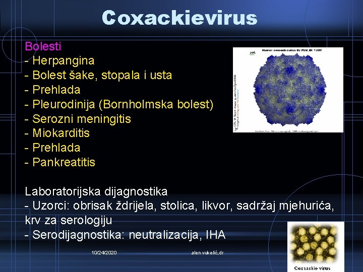 Coxackievirus Bolesti - Herpangina - Bolest šake, stopala i usta - Prehlada - Pleurodinija