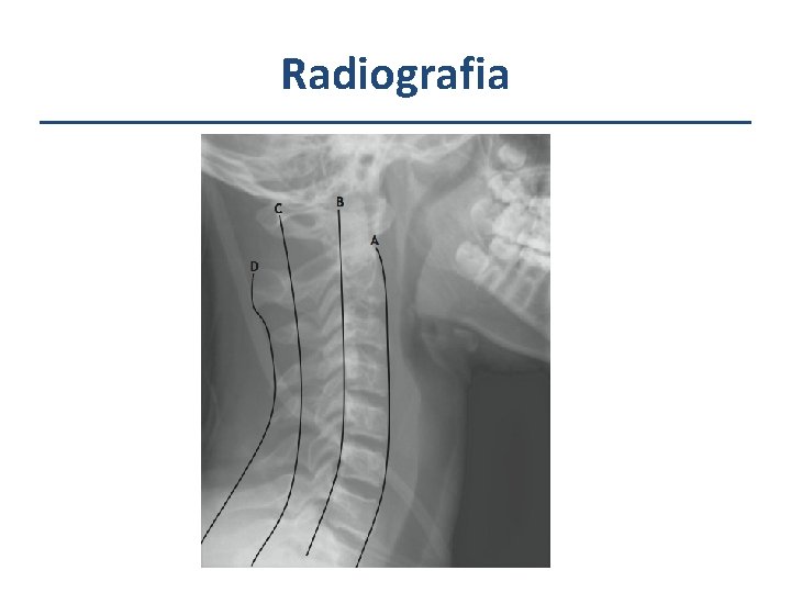 Radiografia 