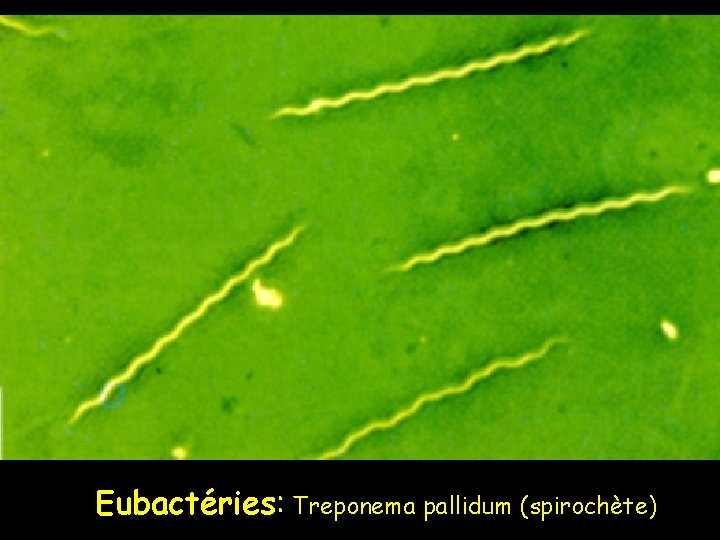 Eubactéries: Treponema pallidum (spirochète) 