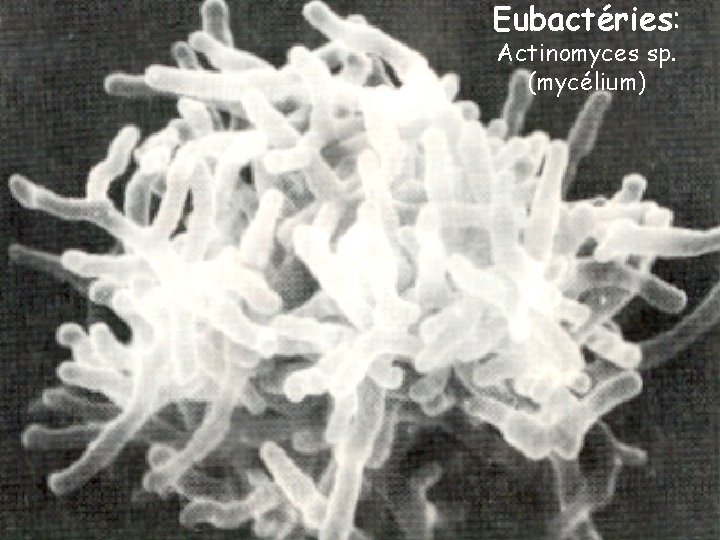 Eubactéries: Actinomyces sp. (mycélium) 