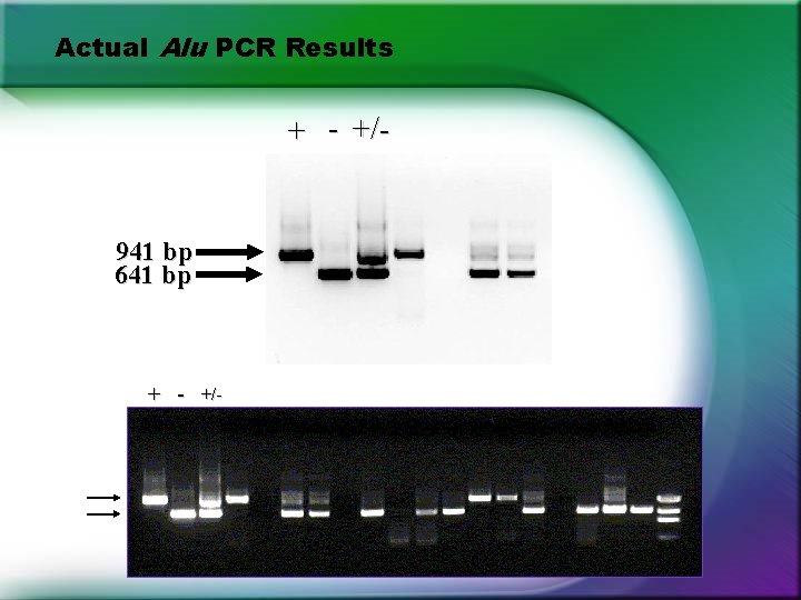 Actual Alu PCR Results + - +/- 941 bp 641 bp + - +/- Actual Alu PCR Results + - +/- 941 bp 641 bp + - +/-