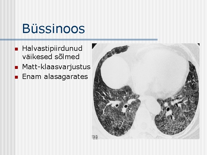 Büssinoos n n n Halvastipiirdunud väikesed sõlmed Matt-klaasvarjustus Enam alasagarates 