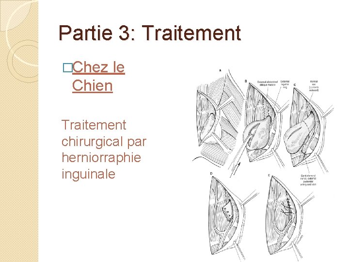 Partie 3: Traitement �Chez le Chien Traitement chirurgical par herniorraphie inguinale 