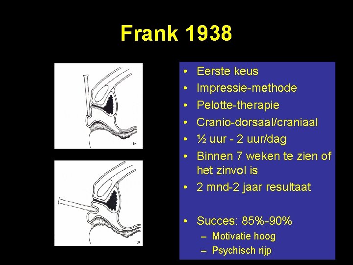 Frank 1938 • • • Eerste keus Impressie-methode Pelotte-therapie Cranio-dorsaal/craniaal ½ uur - 2