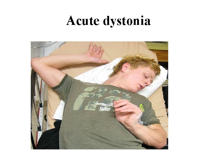 Acute dystonia 