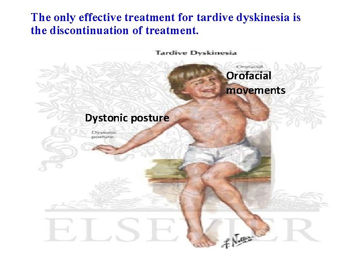 The only effective treatment for tardive dyskinesia is the discontinuation of treatment. Orofacial movements