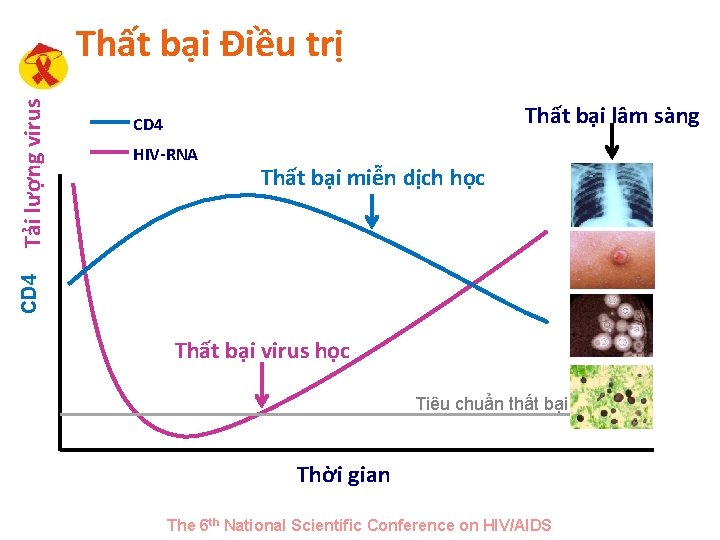 Thất bại lâm sàng CD 4 HIV-RNA Thất bại miễn dịch học CD 4