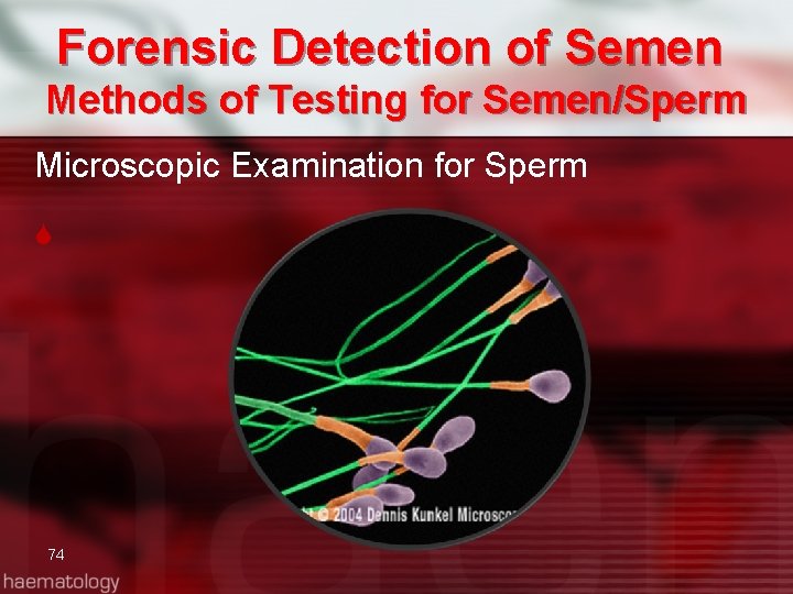 Forensic Detection of Semen Methods of Testing for Semen/Sperm Microscopic Examination for Sperm 74