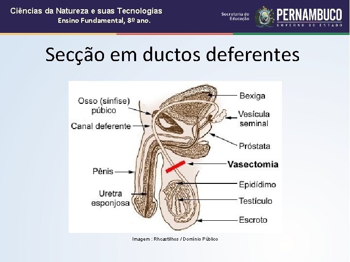 Ciências da Natureza e suas Tecnologias Ensino Fundamental, 8º ano. Secção em ductos deferentes