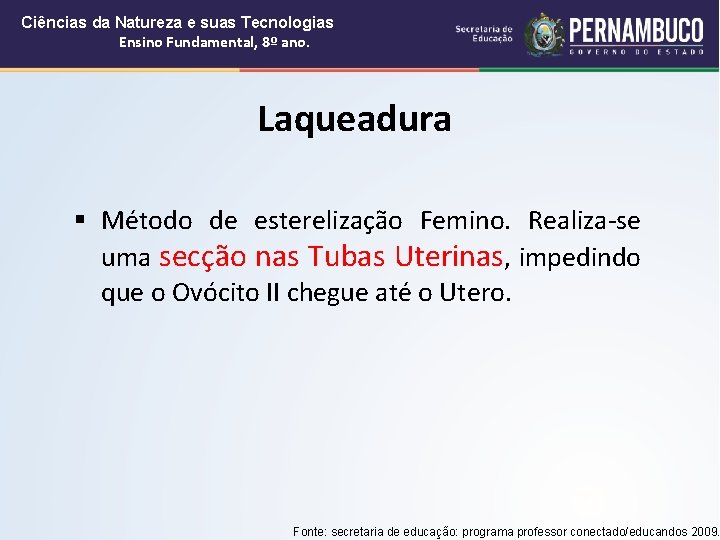 Ciências da Natureza e suas Tecnologias Ensino Fundamental, 8º ano. Laqueadura § Método de