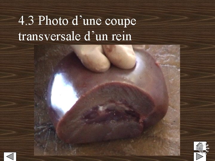 4. 3 Photo d’une coupe transversale d’un rein 