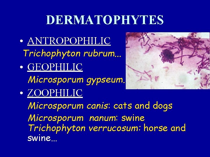 DERMATOPHYTES • ANTROPOPHILIC Trichophyton rubrum. . . • GEOPHILIC Microsporum gypseum. . . •