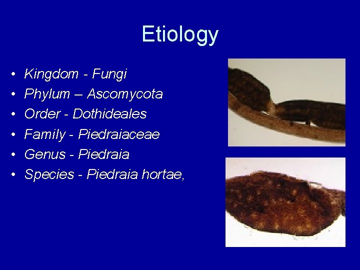 Etiology • • • Kingdom - Fungi Phylum – Ascomycota Order - Dothideales Family