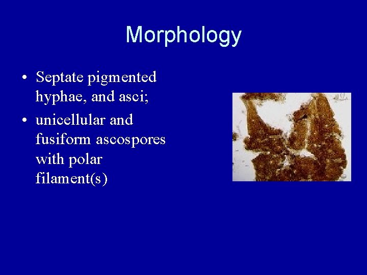 Morphology • Septate pigmented hyphae, and asci; • unicellular and fusiform ascospores with polar