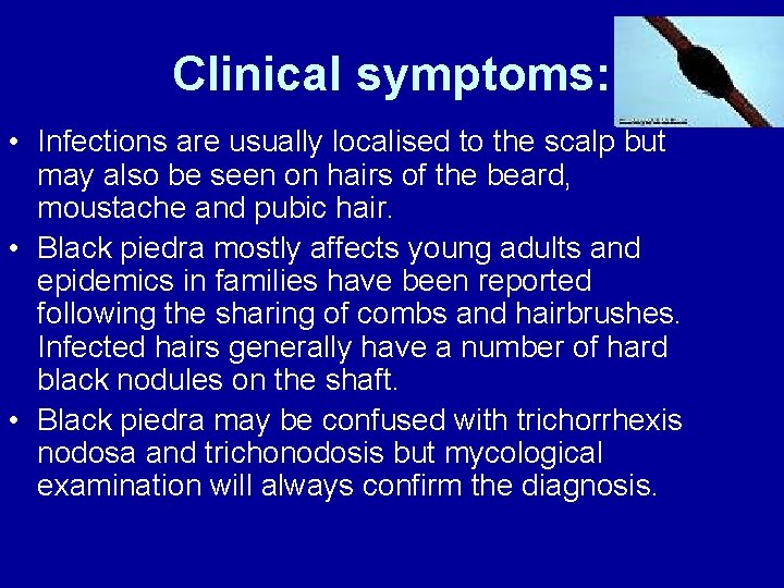 Clinical symptoms: • Infections are usually localised to the scalp but may also be