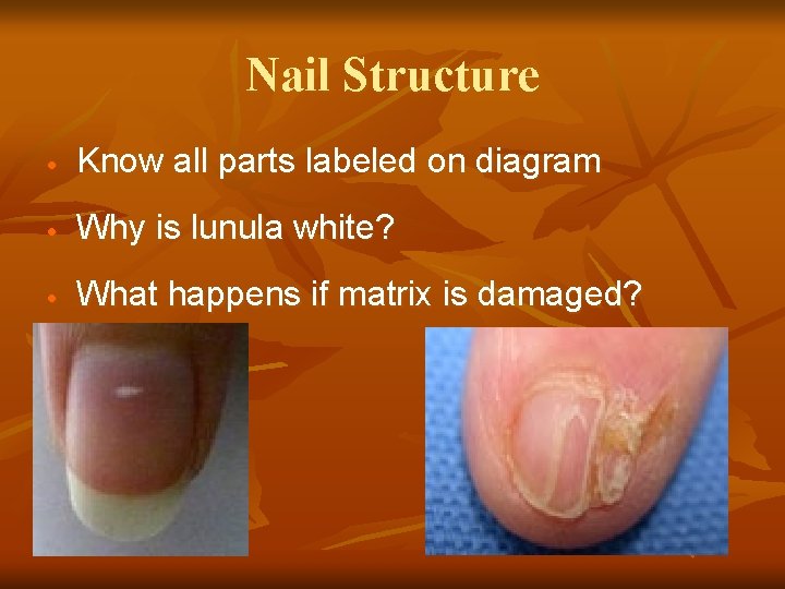 Nail Structure · Know all parts labeled on diagram · Why is lunula white?