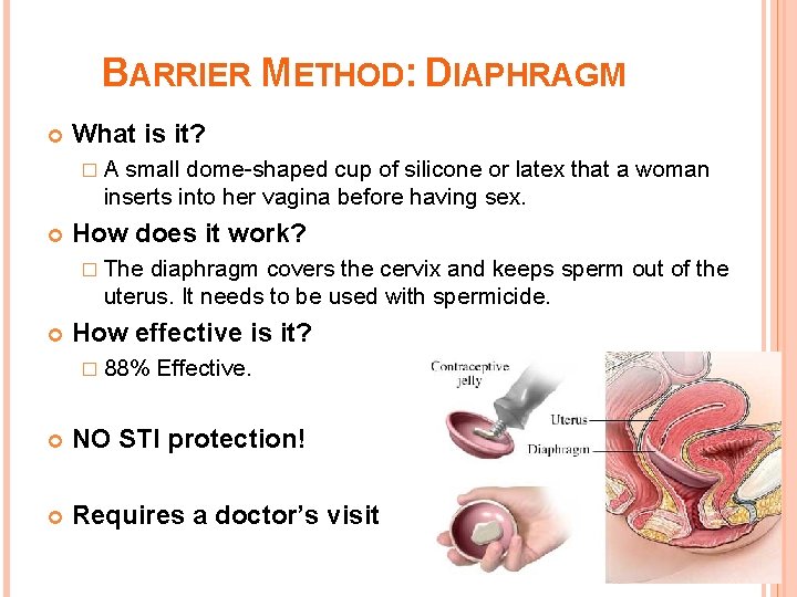 BARRIER METHOD: DIAPHRAGM What is it? �A small dome-shaped cup of silicone or latex