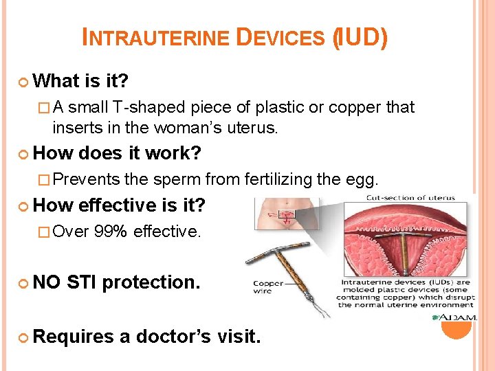 INTRAUTERINE DEVICES (IUD) What is it? �A small T-shaped piece of plastic or copper
